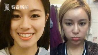 整容的视频,从素颜到蜕变