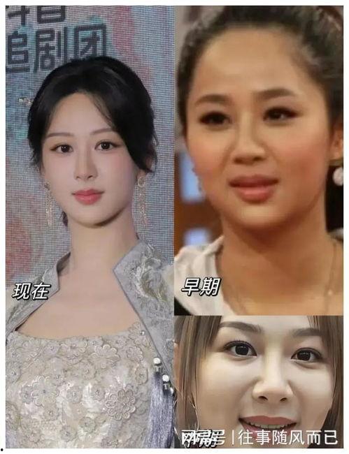 整容的视频,从素颜到蜕变